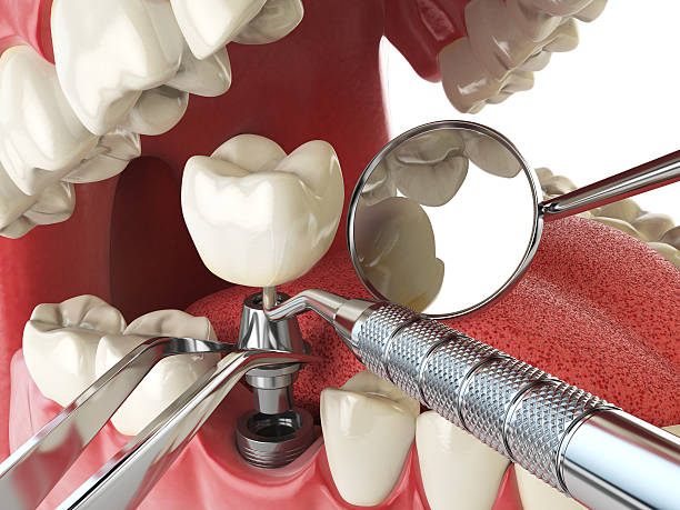 Best Emergency Dental Care for Broken or Chipped Teeth in Lantana, TX